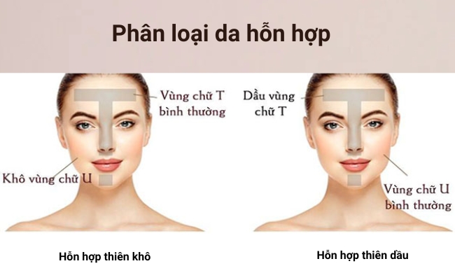 Da hỗn hợp